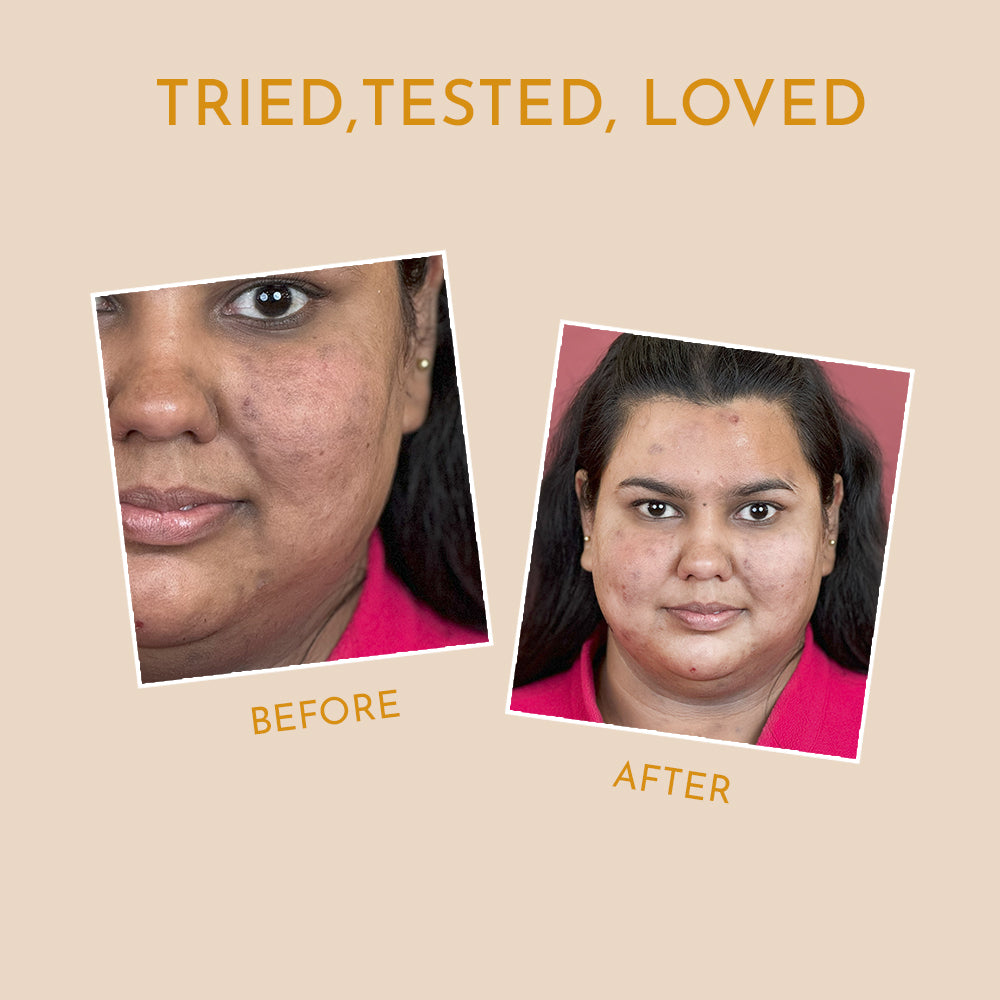 Tried, Tested, Loved graphic showing a side‑by‑side before and after face photo comparison, showing results of best vitamin c face wash.