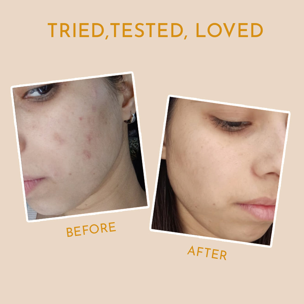 A compelling before and after image of a user&