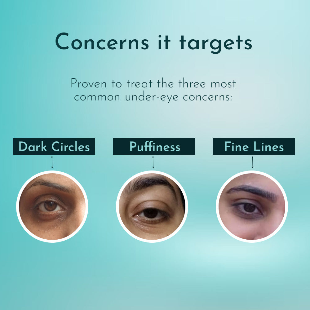 An image showing three common under-eye concerns: dark circles, puffiness, and fine lines, demonstrating what the product is proven to treat.