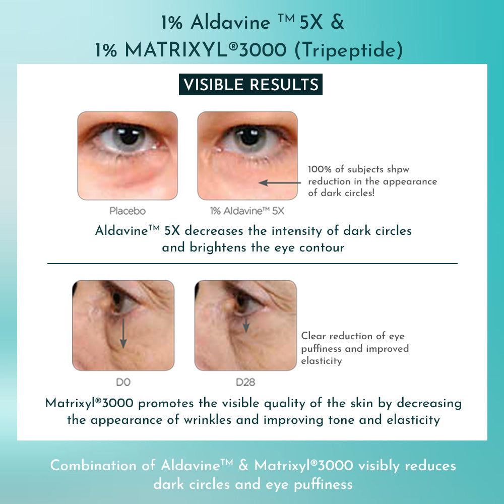 A before-and-after graphic demonstrating how Aldavine 5X reduces dark circles and how Matrixyl 3000 improves eye puffiness and elasticity.