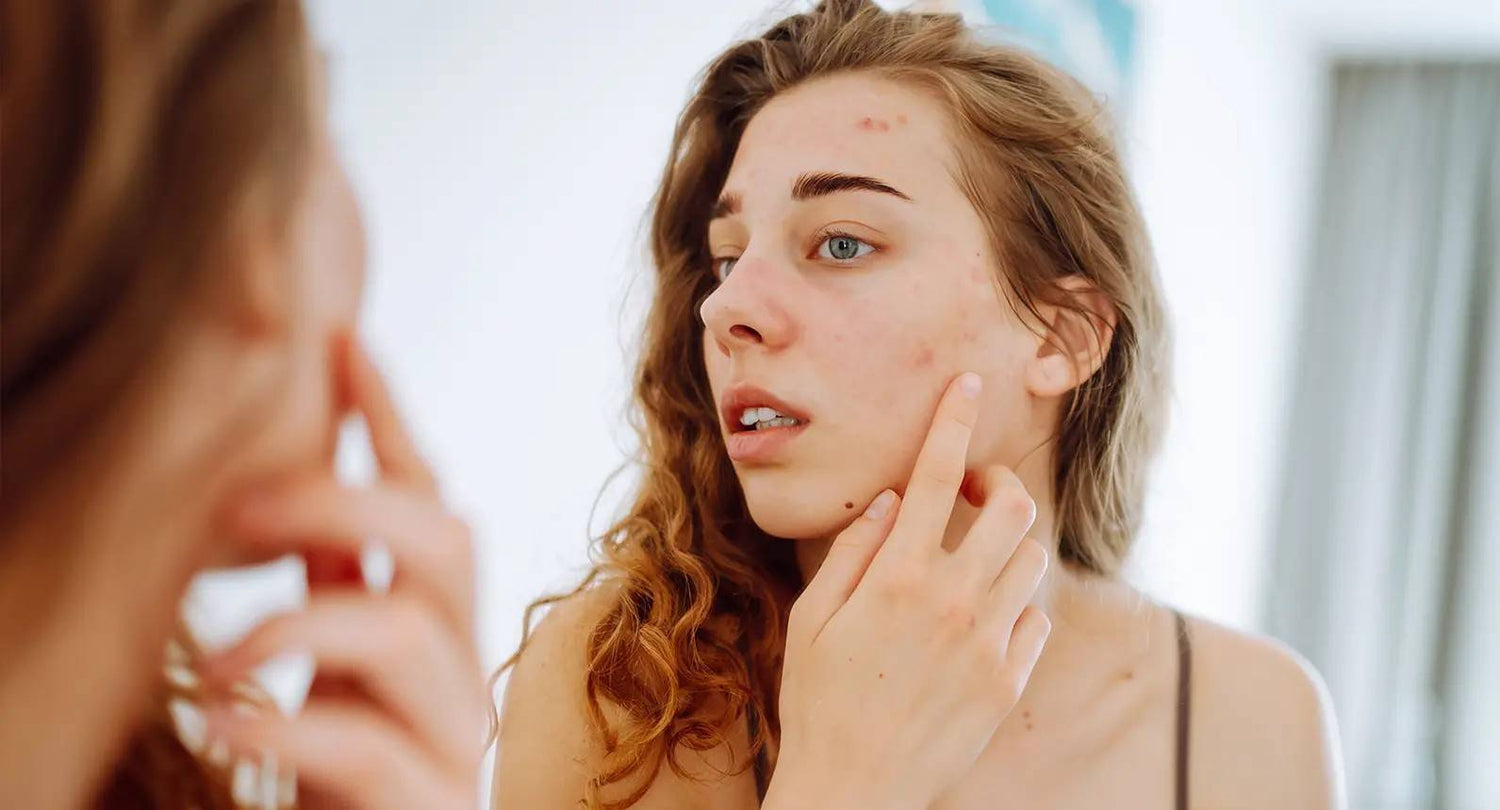 Why Your Skin Looks Dull After Your Period And How to Fix It