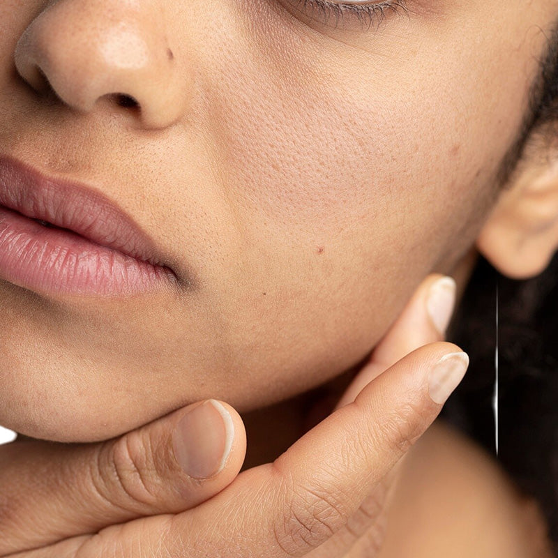 Skin Dehydration